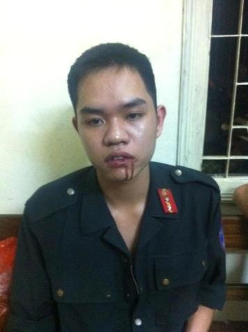 CSCĐ Nguyễn Văn Sang với vết thương ở miệng